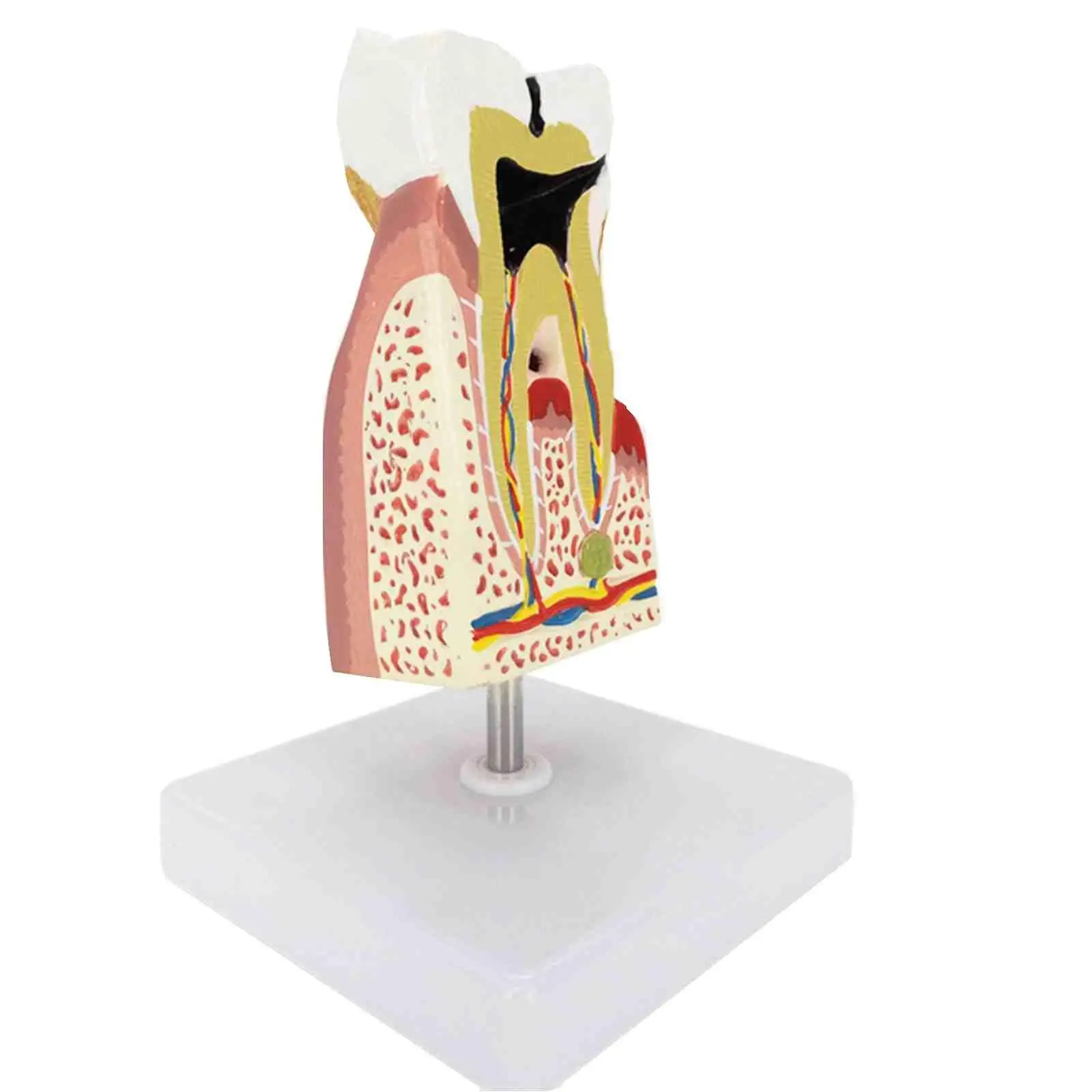 Анатомическая модель больных зубов человека из ПВХ, медицинская анатомия для обучения пациентов